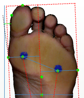 3D foot scanner