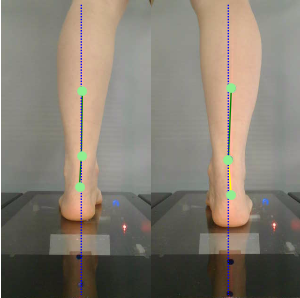 3D foot scanner