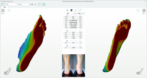 3D foot scanner