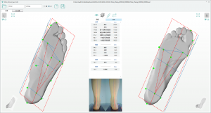 3D foot scanner