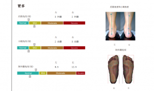 3D foot scanner