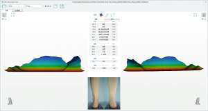 3D foot scanner
