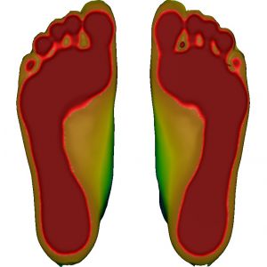 3D foot scanner