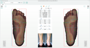 3D foot scanner