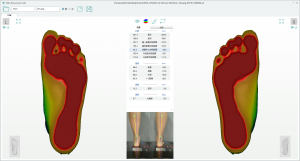 3D foot scanner
