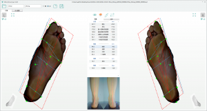 3D foot scanner