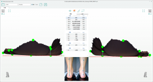 3D foot scanner