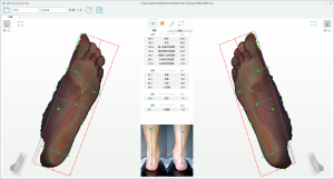 3D foot scanner
