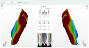 3D foot scanner