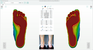 3D foot scanner