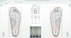 3D foot scanner