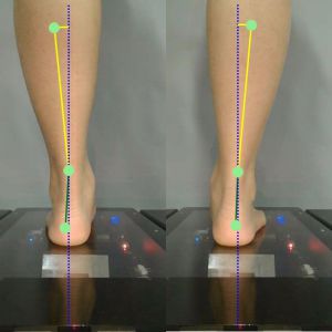 3D foot scanner