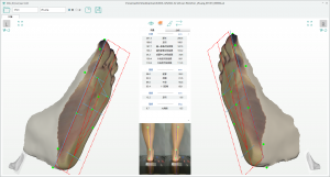 3D foot scanner