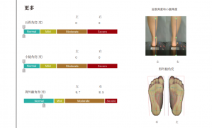 3D foot scanner