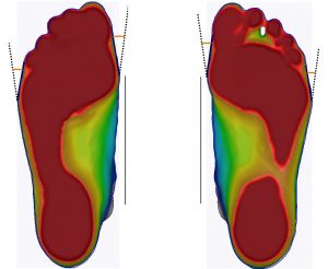 3D foot scanner