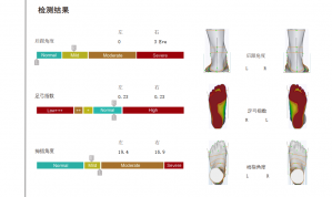3D foot scanner 三维足部扫描仪