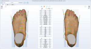 3D foot scanner