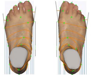 3D foot scanner