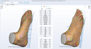 3D foot scanner