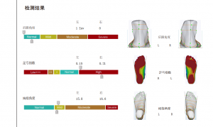 3D foot scanner