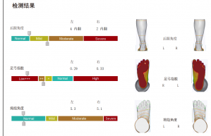 3D foot scanner 三维足部扫描仪